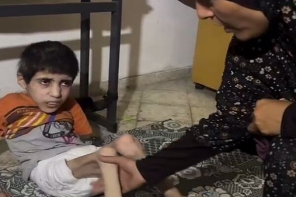 תמונות מזעזעות של מצבו של הילד הפלסטיני כתוצאה מרעב קיצוני